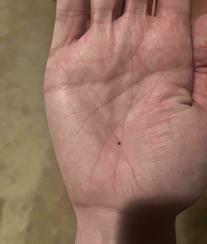 Close-up of palm with a tiny black dot in the center, one of many moderately interesting moments shared online.