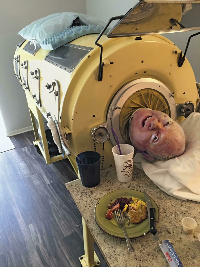 One Of The Last People To Live In An Iron Lung. At 6 Years Old, Alexander Was Diagnosed With Polio Which Lead To Paralysis From His Neck Down.the Machine Is Made To Compress And Depress The Chest. Today, He Is 74 Years Old And He Still Relies On The Iron Lung To Keep Him Alive