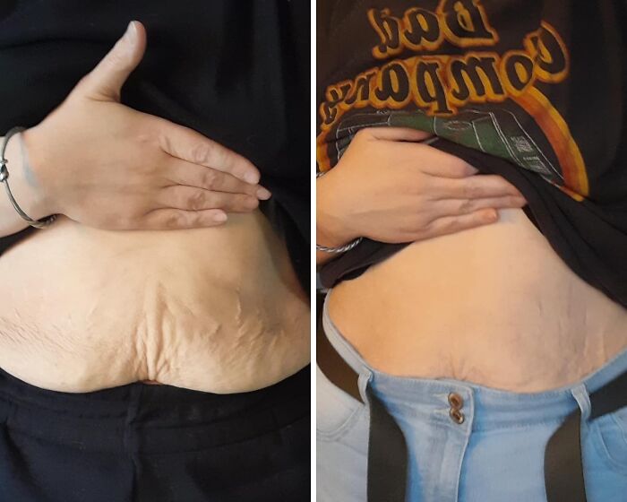 Before and after photos showing improved skin appearance, illustrating clever finds for daily annoyances under $20.