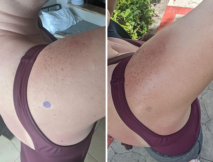 Close-up of a person’s freckled shoulder wearing a maroon top, illustrating heatwave hacks for summer comfort.