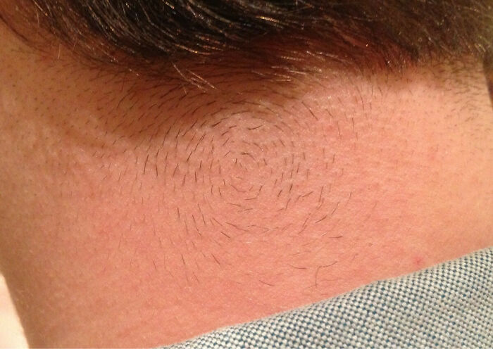 Primer plano del rasgo distintivo de la línea del cabello en espiral, un rasgo único del cuerpo humano que destaca a la gente.