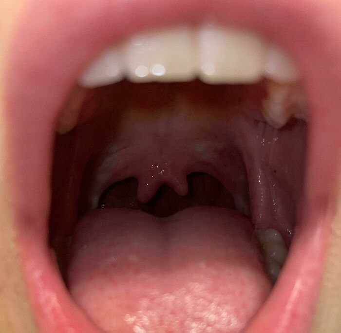 Close-up view inside an open mouth showing tongue, teeth, and throat, highlighting unique human body features.