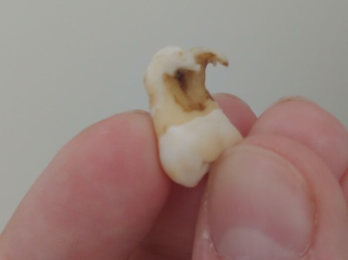 Diente humano con rasgos distintivos sostenido entre dedos, mostrando características únicas del cuerpo humano.