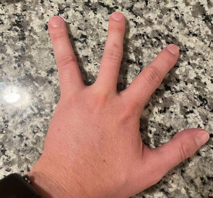 Mano extendida sobre superficie de granito mostrando rasgos distintivos del cuerpo humano en dedos y piel.