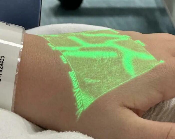 Wrist with medical band and green projected light, illustrating fascinating and wild things that can happen to the human body.