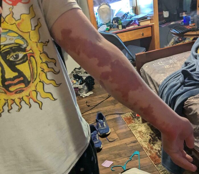 Person showing an amazing and interesting birth mark on their forearm in a casual indoor setting.