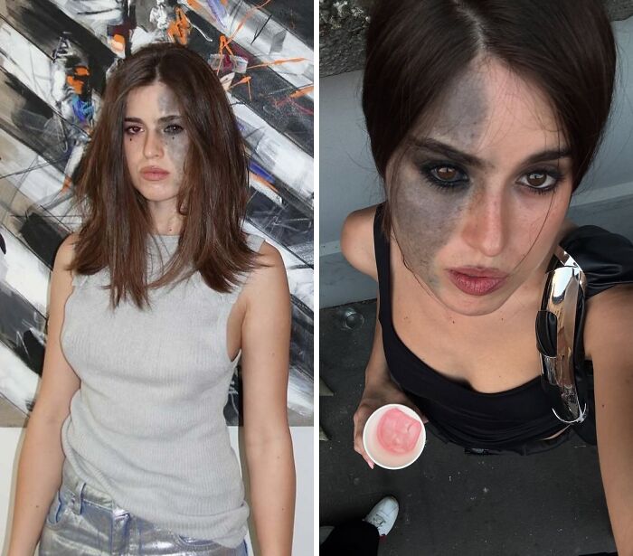 Young woman with a large dark birthmark on her face, shown in two different outfits and settings.