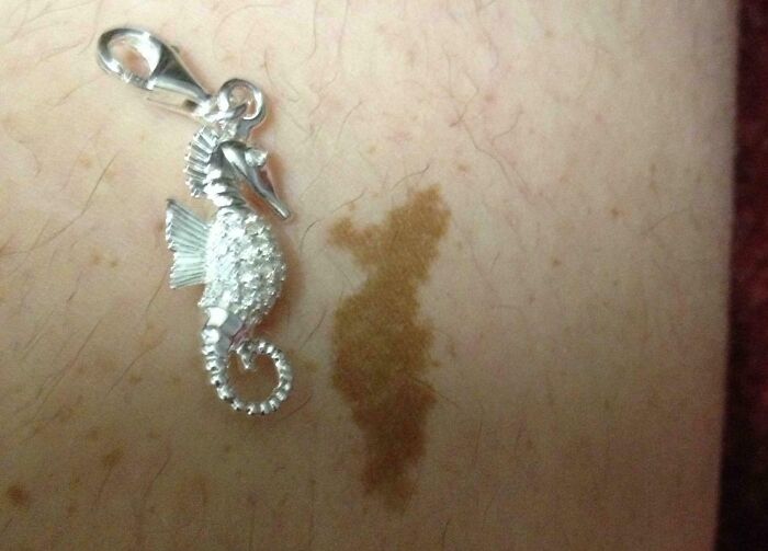 Close-up of a birthmark resembling a seahorse next to a silver seahorse charm on skin showcasing unique birth marks.
