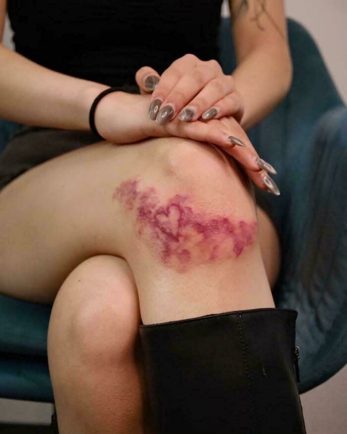 Close-up of a person's leg with a bruise shaped like a heart, illustrating awful taste but great e*******n.