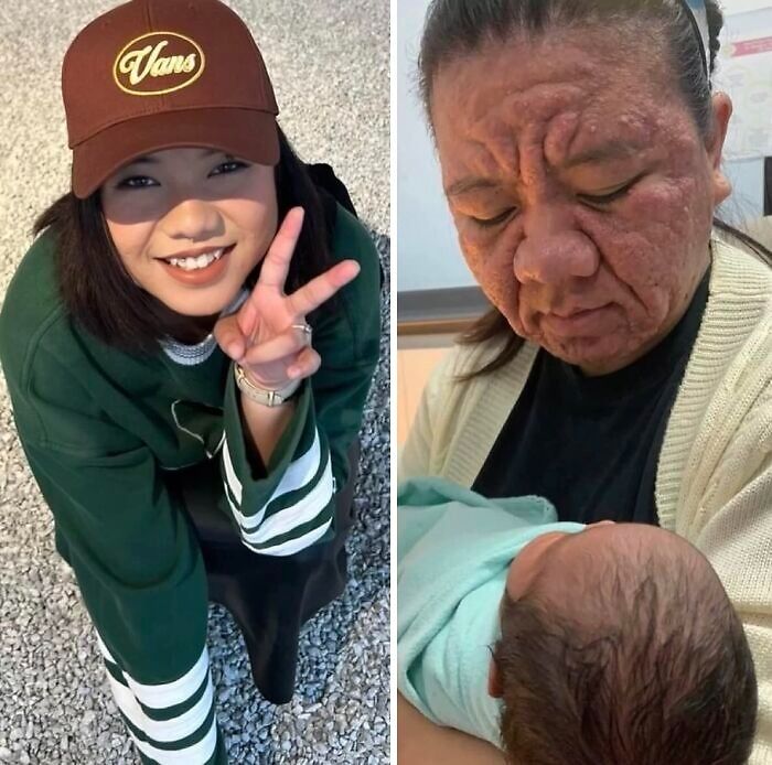 Split image showing a smiling young woman and a distressed older woman with skin condition holding a baby, unsettling images concept.