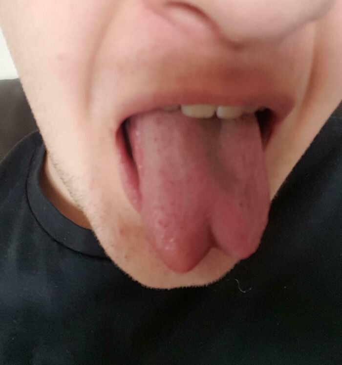 Primer plano de una lengua bifurcada, un rasgo distintivo del cuerpo humano que hace destacar a la gente.