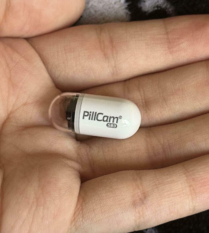 Small PillCam capsule camera resting on an open palm demonstrating advanced human body technology.