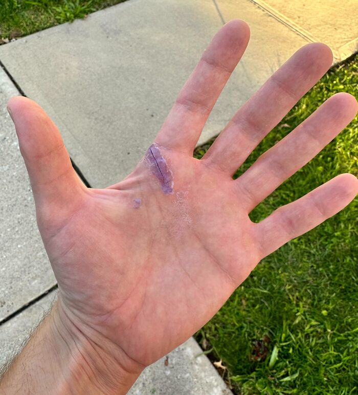 Close-up of a human hand showing an extra finger, illustrating a fascinating and wild body anomaly.