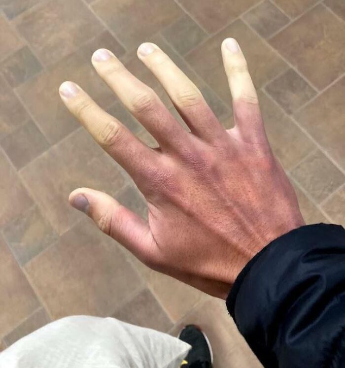 Hand with an extra finger visible, showing unique human body variation in natural light on a tiled floor background.