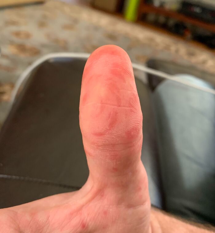 Close-up of a human thumb showing detailed skin texture, highlighting a possible extra finger or unusual finger characteristic.