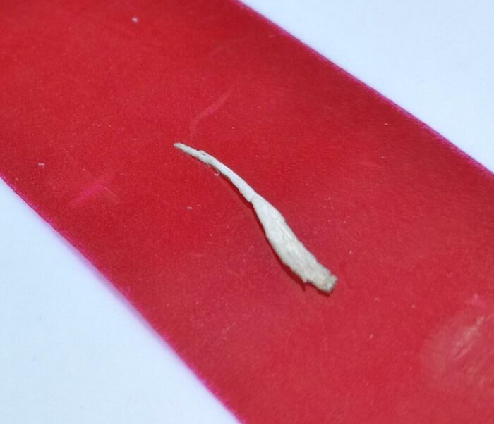 Small extra finger tissue displayed on a red surface, illustrating unusual human body variations and extra finger occurrence.