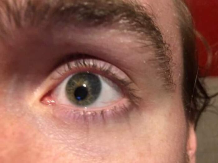 Close-up of a human eye showing unique details, illustrating fascinating and wild things that can happen to the human body.