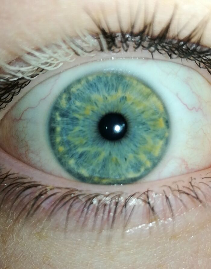 Primer plano de un ojo con iris azul y amarillo, mostrando rasgos distintivos del cuerpo humano que hacen destacar a la gente.