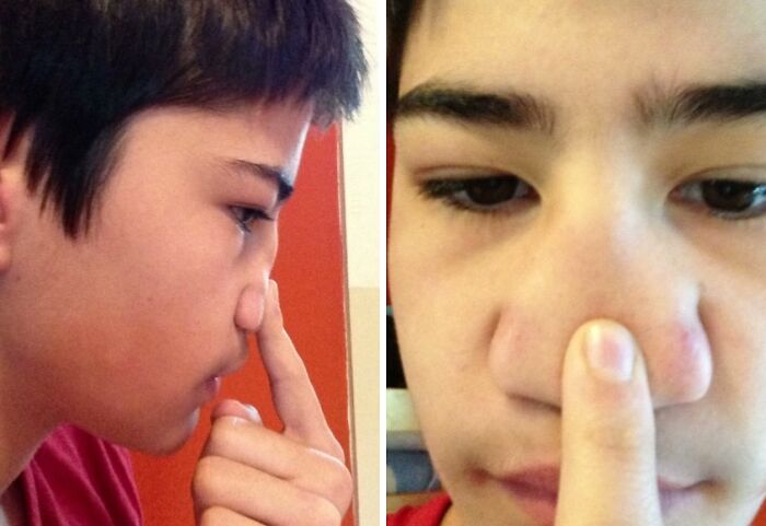 Niño mostrando un rasgo distintivo del cuerpo humano en la nariz que hace destacar a la gente.