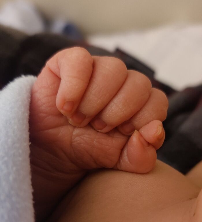 Close-up of a baby’s hand showing an extra finger, illustrating a fascinating and wild human body anomaly.