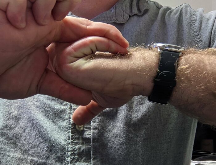 Mano y brazo con rasgos distintivos del cuerpo humano, resaltando detalles únicos de la piel y vello corporal.