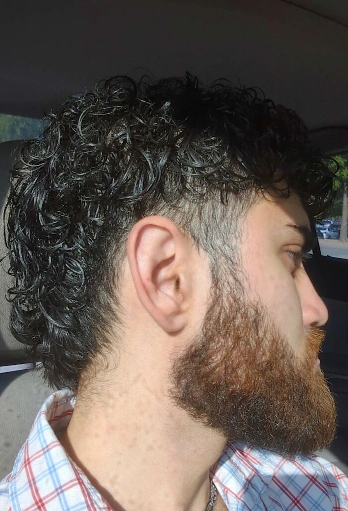 Side profile of a man with curly hair and a full beard, highlighting unique and wild things that can happen to the human body.