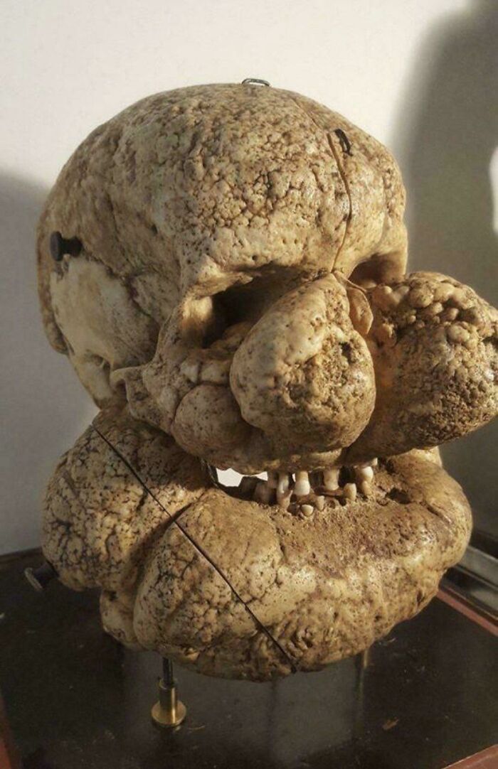 Large, textured sculpture resembling a distorted teddy bear head