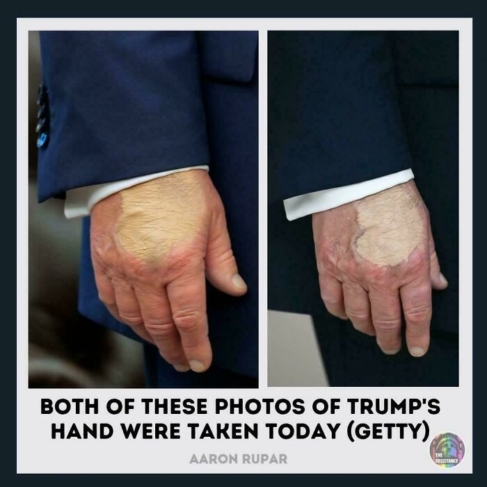 Close-up of a hand showing skin changes, illustrating a moment when there was an attempt but the universe had different plans.