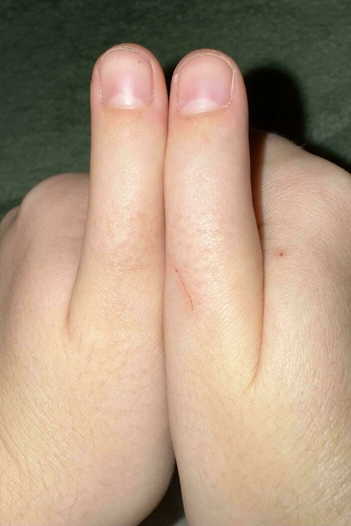 Close-up of two fingers pressed side by side showing a unique moderately interesting hand feature.