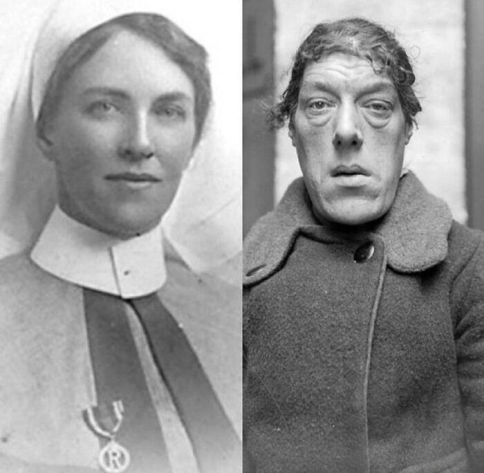 Black and white unsettling images showing a nurse and a man with a distorted face from the morbid knowledge online group.