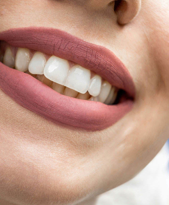 Close-up of a smiling mouth with white teeth and matte lipstick illustrating things Americans do that make them stand out abroad