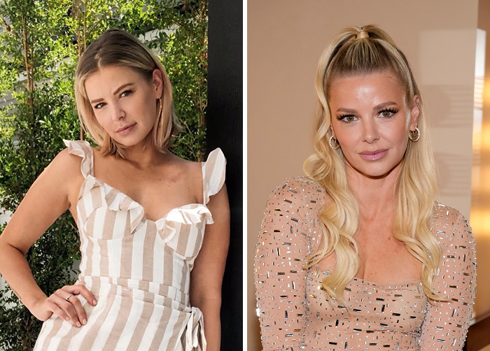 Before-and-after photos of a Ariana Madix celeb who replaced regular Botox with lip flip for a new look.