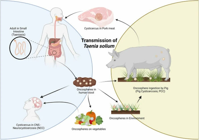 Man Develops &lsquo;Pork Worms&rsquo; In His Brain After Common Bacon Habit