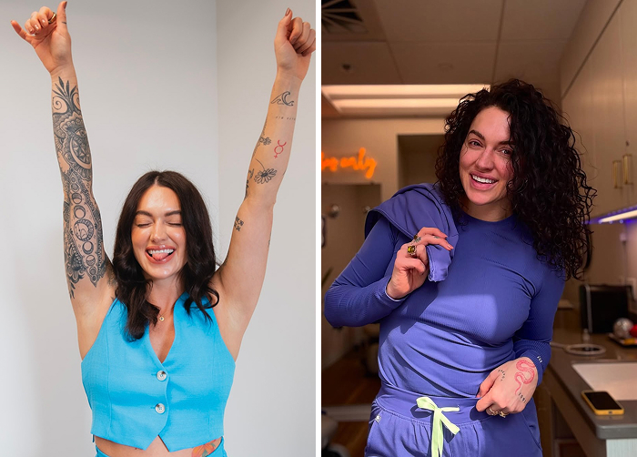 Before and after photos of a Brooke Carrero showing results of a lip flip procedure replacing regular Botox for a natural look.