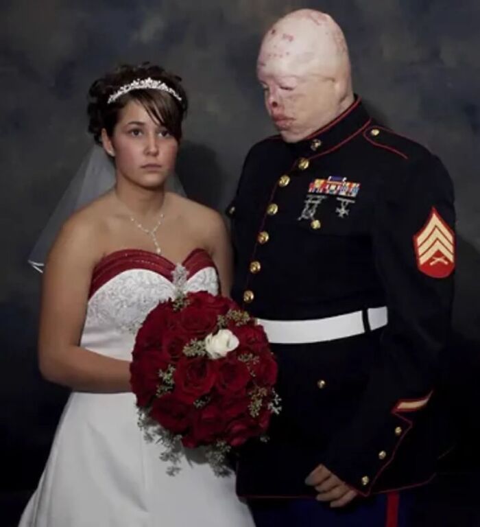 Bride holding bouquet of red roses standing next to a man in military uniform with facial deformities, unsettling image.