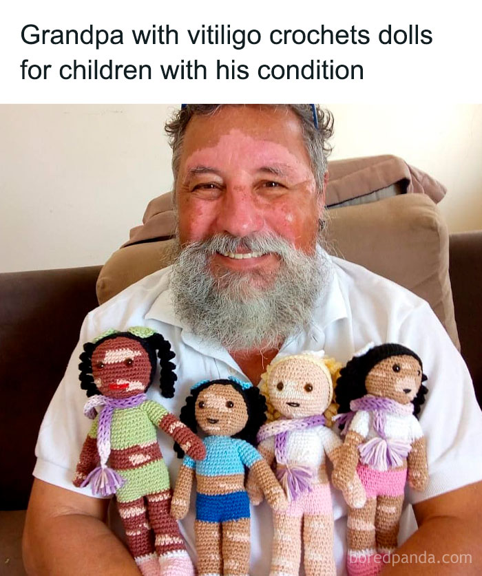 Grandpa holding crafty crocheted dolls representing vitiligo, showcasing ingenious crafty ideas for children with the condition.