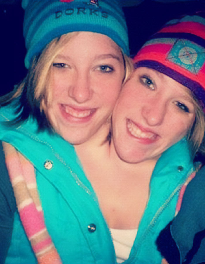 Conjoined twins Abby and Brittany Hensel smiling outdoors wearing colorful winter hats and jackets. Conjoined twins Abby and Brittany Hensel smiling outdoors wearing colorful winter hats and jackets.