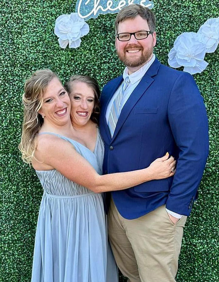 Conjoined twins Abby and Brittany Hensel smiling with a man against a green floral backdrop at an event. Conjoined twins Abby and Brittany Hensel smiling with a man against a green floral backdrop at an event.