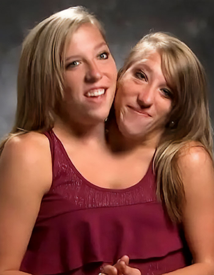 Conjoined twins Abby and Brittany Hensel smiling together in a maroon top, sparking buzz after being seen with a newborn baby. Conjoined twins Abby and Brittany Hensel smiling together in a maroon top, sparking buzz after being seen with a newborn baby.