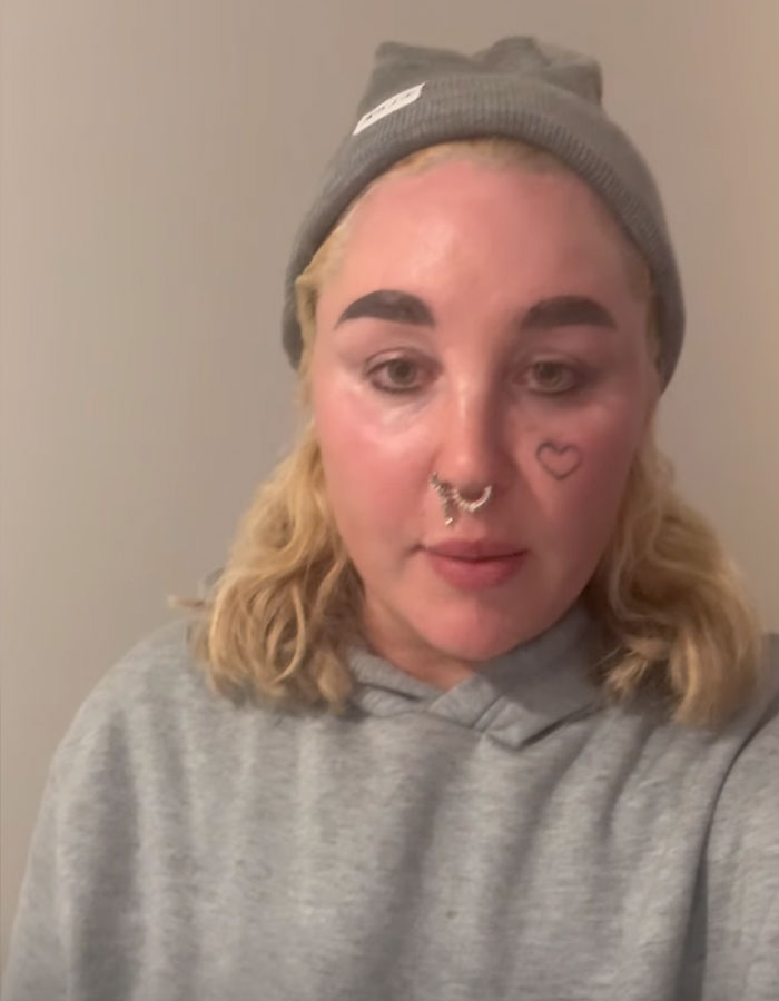 "Love The Lips": Amanda Bynes Shocks Fans With Transformation After Revealing New Cosmetic Procedures