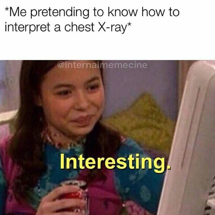 Young woman pretending to understand a chest X-ray, captured in a funny and relatable medical meme about doctor checkups.