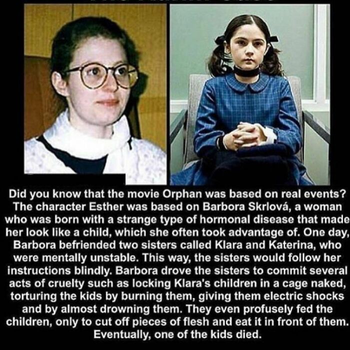 Side-by-side images of Esther from Orphan and a woman with a hormonal disease, illustrating creepy facts to deprive sleep.