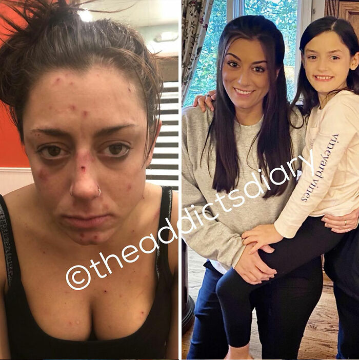 Before-and-after pics showing a woman recovering and rebuilding her life, with improved health and happiness.