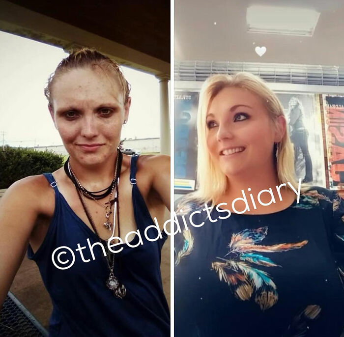 Before-and-after photos showing a woman’s recovery and transformation as part of rebuilding her life.