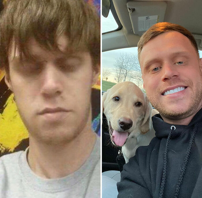 Side-by-side before and after photos showing a man recovering and rebuilding his life with a smiling dog in the second image.