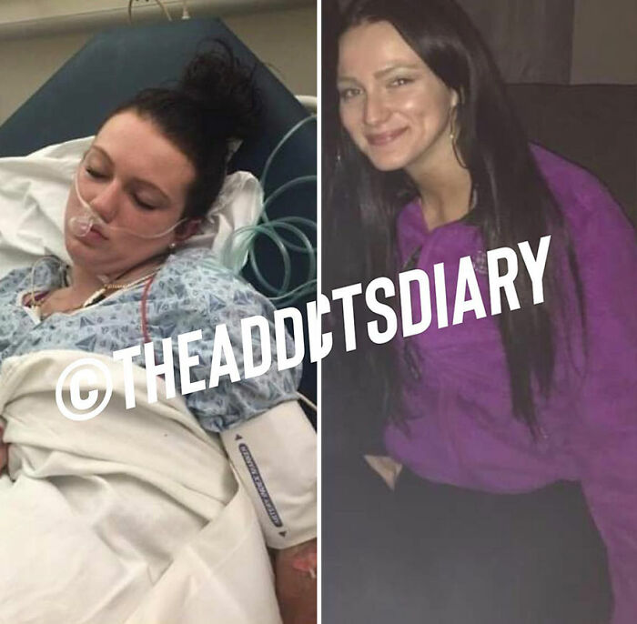 Side-by-side before-and-after pics of a woman recovering and rebuilding her life after a hospital stay.