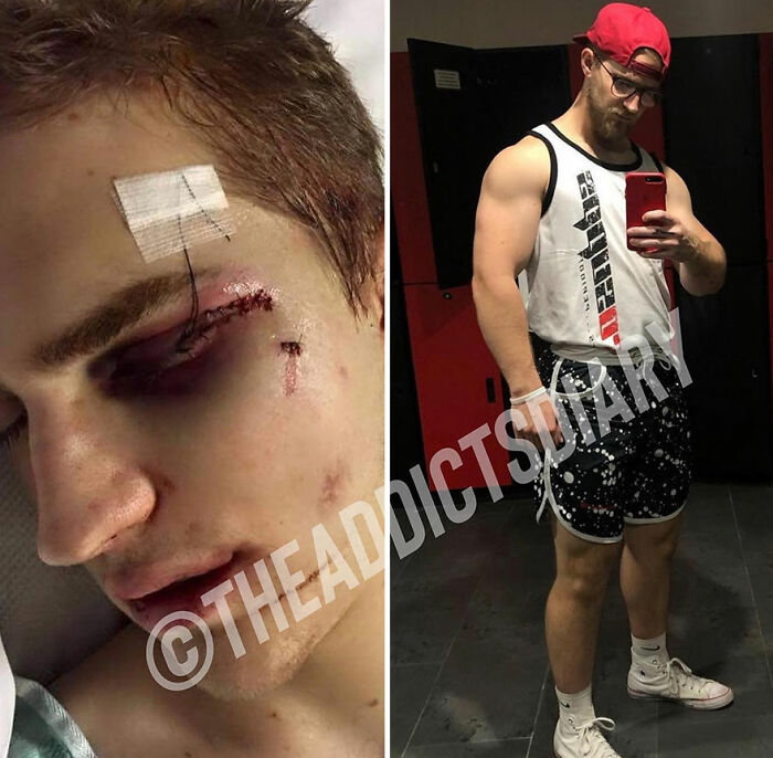 Before-and-after image showing a man recovering with facial injuries and later rebuilding his life fitness and strength.