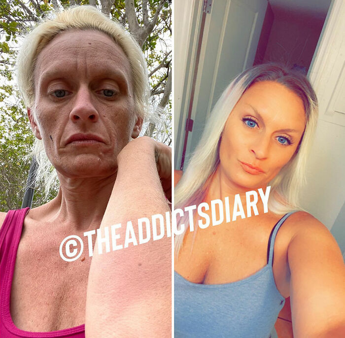 Before-and-after photos of a woman showing recovery and rebuilding her life with improved health and appearance.