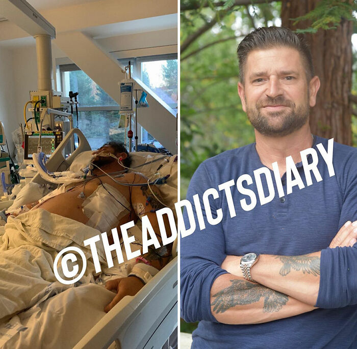 Side-by-side before and after photos showing a man recovering and rebuilding his life after a medical crisis.