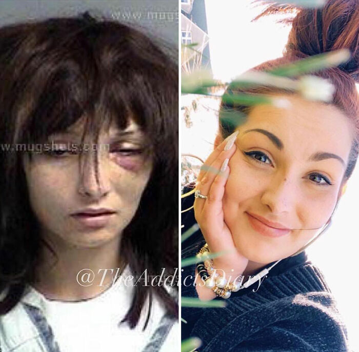 Side-by-side before and after photos showing a woman recovering and rebuilding her life with a bright smile and healthy appearance.